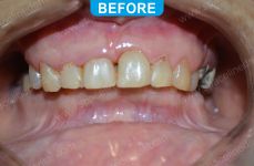 Cosmetic Dentistry - 1-1