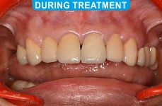 Cosmetic Dentistry - 1-3