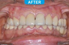 Cosmetic Dentistry - 1-4 (1)