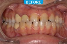 Cosmetic Dentistry - 2-1