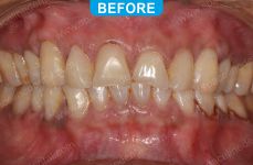 Cosmetic Dentistry - 3-2