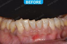 Cosmetic Dentistry - 4-1