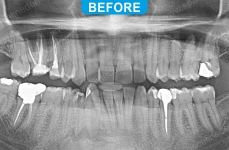 Endodontics - 1-3