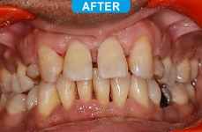 General Dentistry - 3-3
