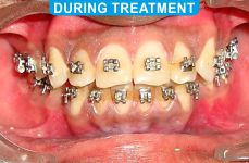 Orthodontics -1-4