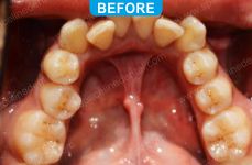 Orthodontics -3-1