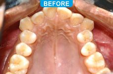 Orthodontics -3-2