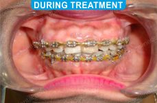Orthodontics -4-2