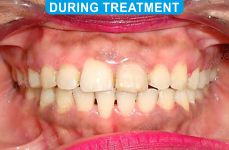 Orthodontics -4-3