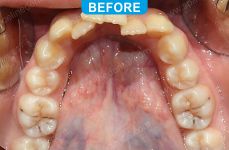 Orthodontics -5-1