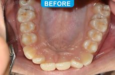 Orthodontics -5-2