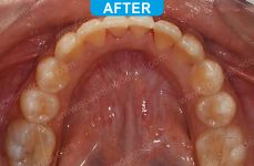 Orthodontics -5-4
