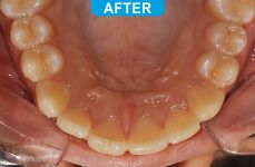 Orthodontics -5-5