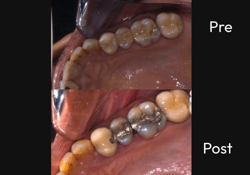 cerac-3