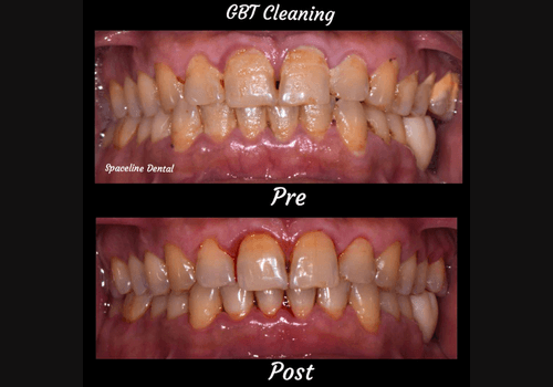 gbt-2