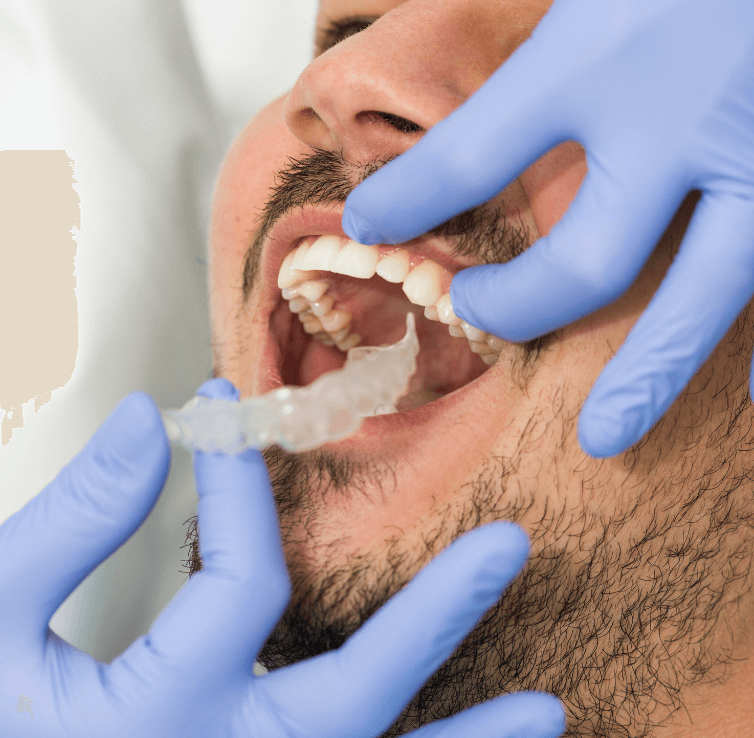 invisible braces in Mumbai