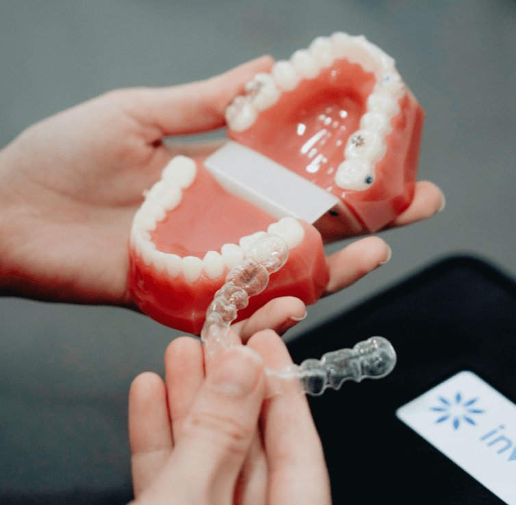 Invisible Orthodontics in Mumbai