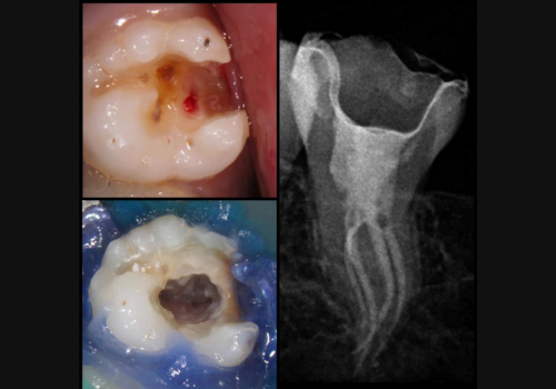 endodontics-1